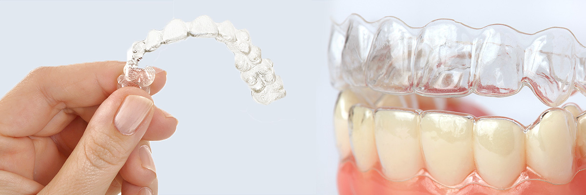 Montville Alternative to Braces for Teens