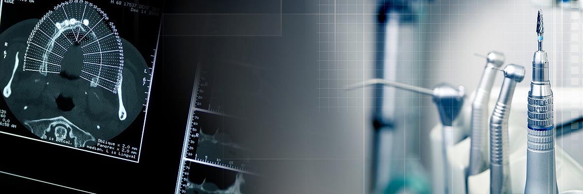 Montville Will I Need a Bone Graft for Dental Implants?