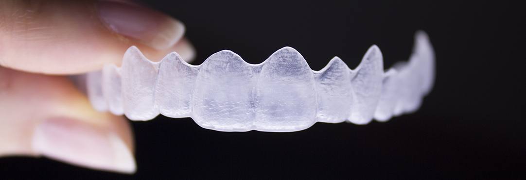 Montville Clear Aligners