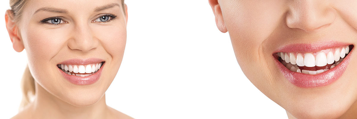 Montville Cosmetic Dental Care