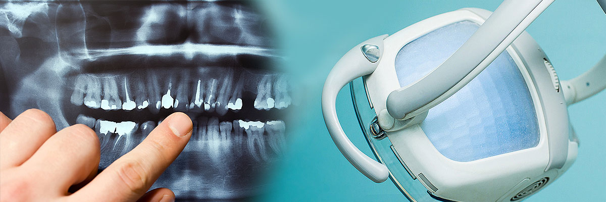 Montville Dental Cleaning