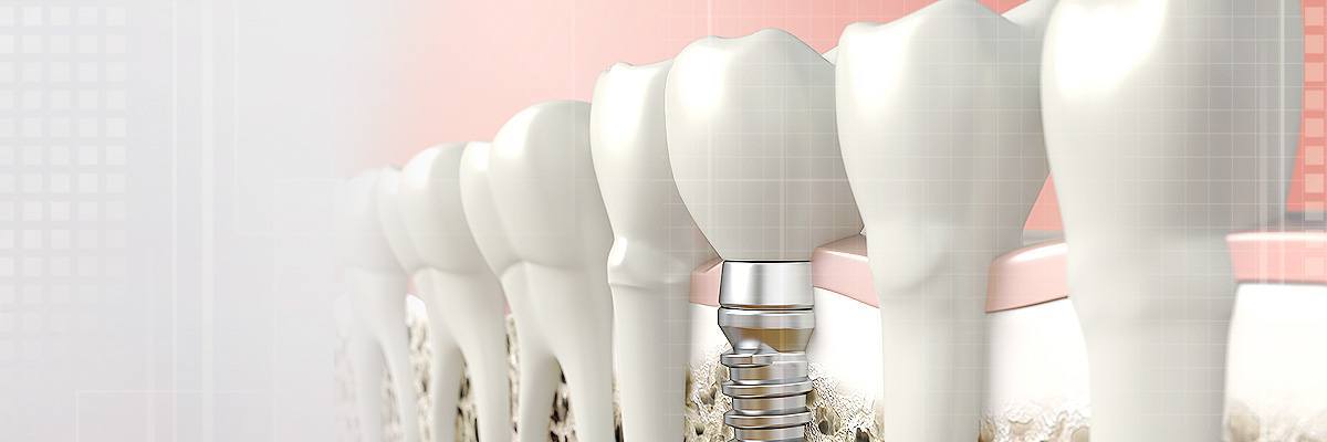 Montville Dental Prosthetics