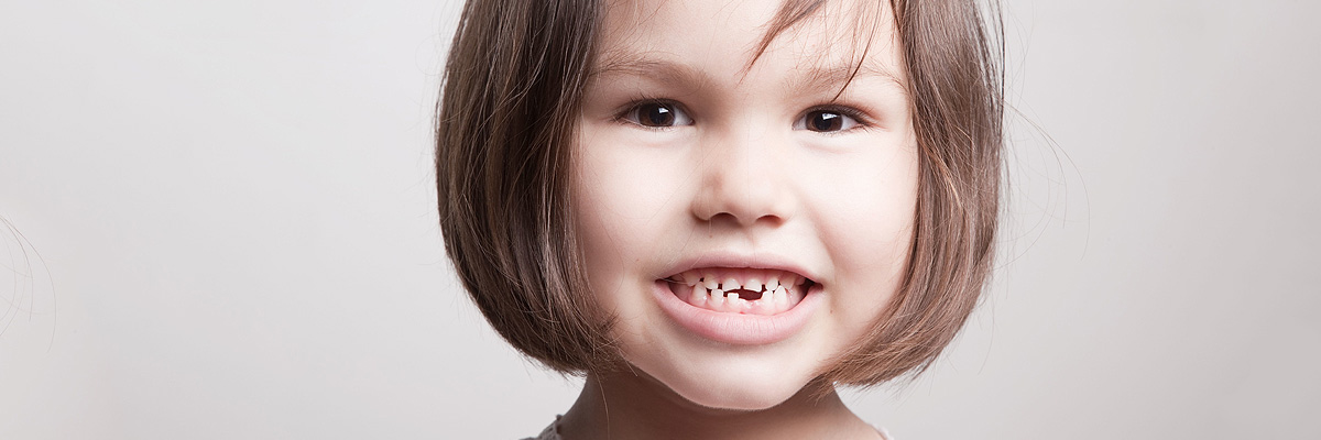 Montville Dental Restoration