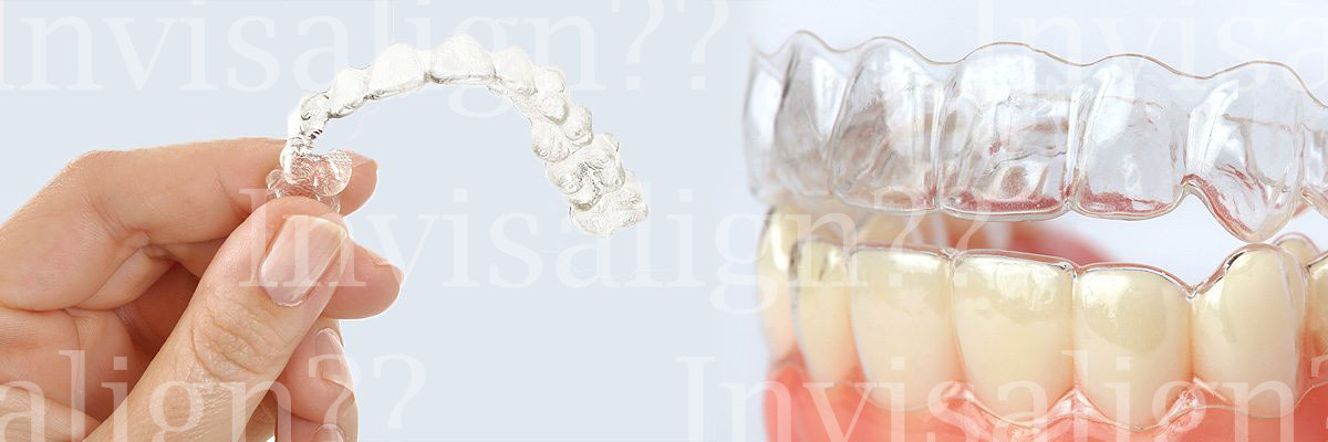 Montville Does Invisalign® Really Work?