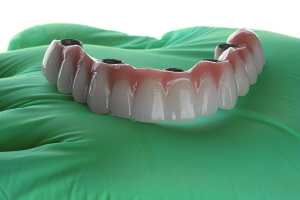 Why You Should Choose Implant Supported Dentures