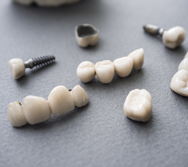 Montville The Difference Between Dental Implants and Mini Dental Implants