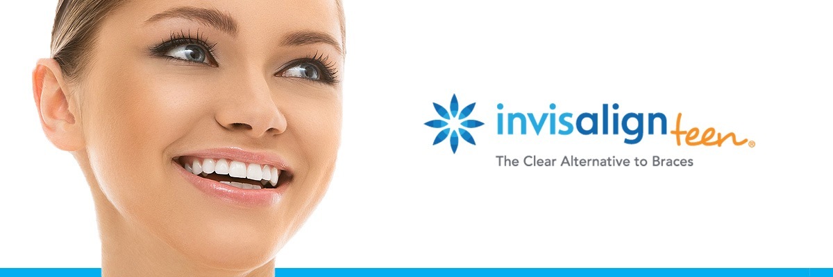 Montville Invisalign vs Traditional Braces