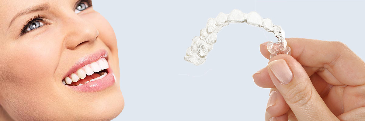Montville 7 Things Parents Need to Know About Invisalign Teen