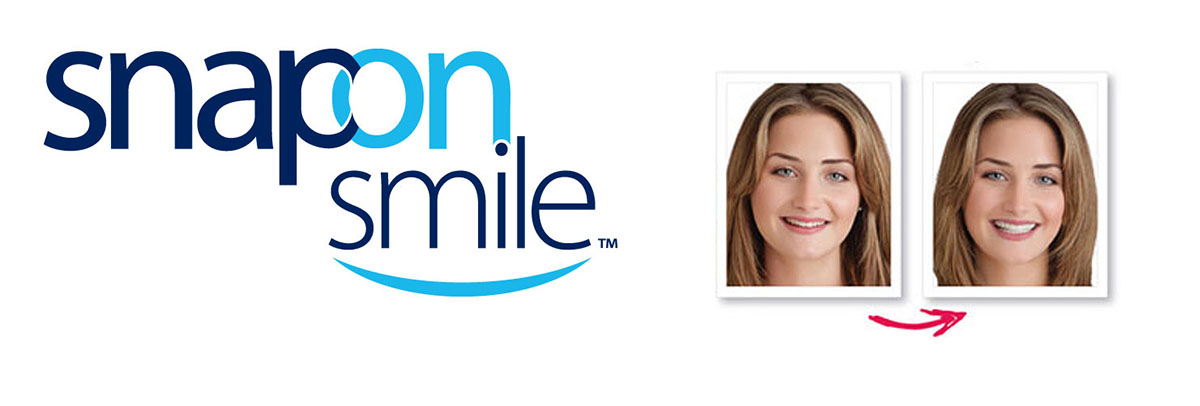 Montville Snap-On Smile