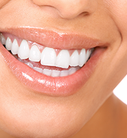 Teeth Whitening Services Montville, NJ