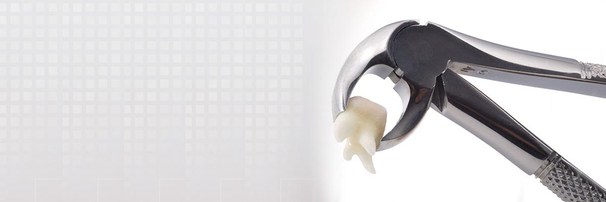 Montville Tooth Extraction