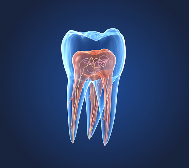 Montville What is an Endodontist